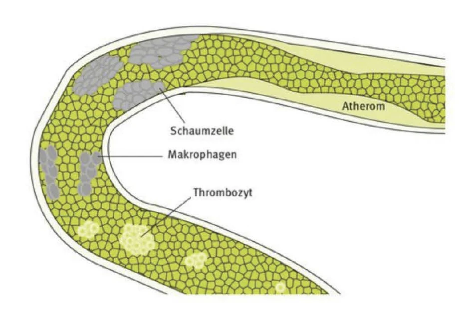 Schaumzelle Schaumzelle